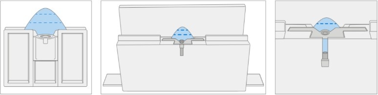 Screenshot that shows installing the depth-marked pick into the Surface Display Debonding Tool at the 2-mm setting.